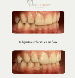 Screenshot 2025 05 21 at 13 50 06 cazuri clinice Clinica dentara