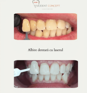 Screenshot 2025 05 21 at 13 50 15 cazuri clinice Clinica dentara