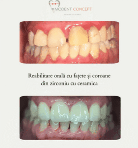 Screenshot 2025 05 21 at 13 50 33 cazuri clinice Clinica dentara