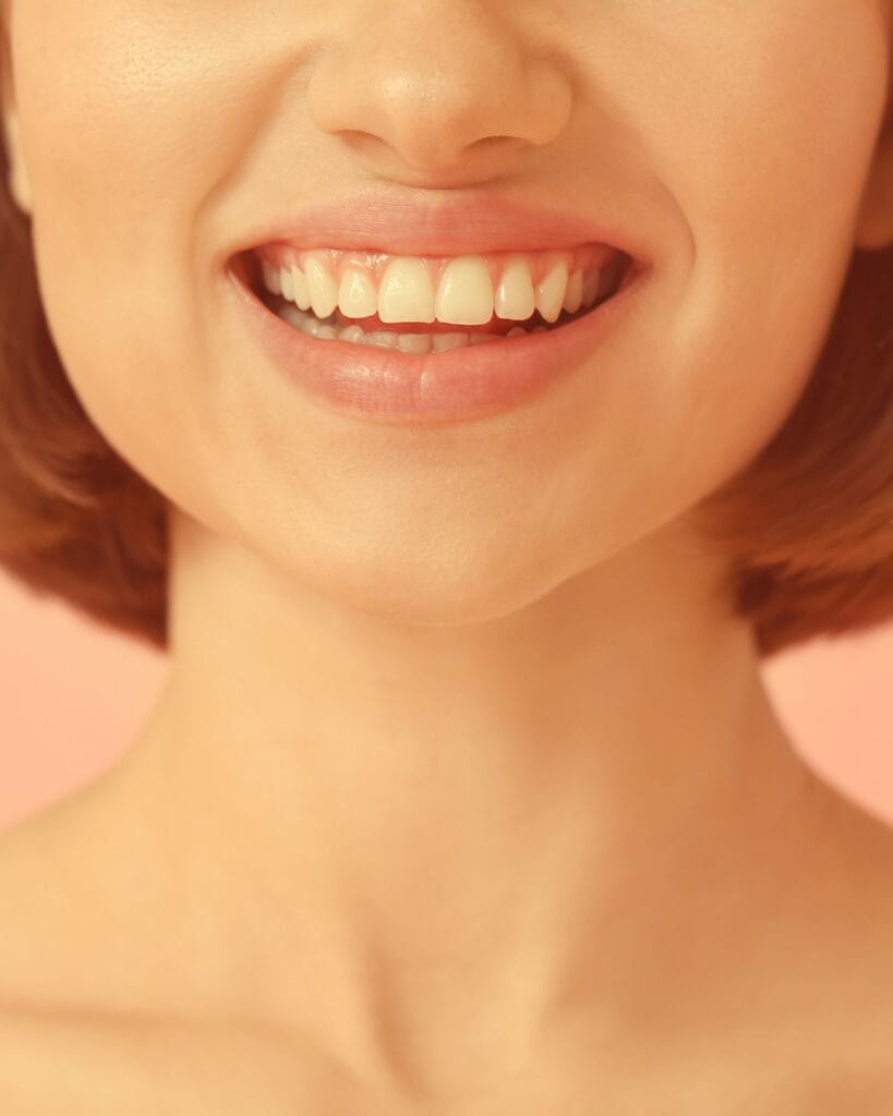 Grefe gingivale Modent Concept